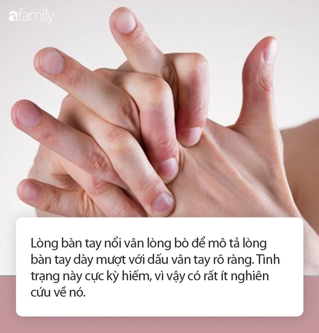 Cảnh báo: Nếu bạn xuất hiện dấu hiệu này ở lòng bàn tay, rất có thể đã bị ung thư phổi! - Ảnh 4.