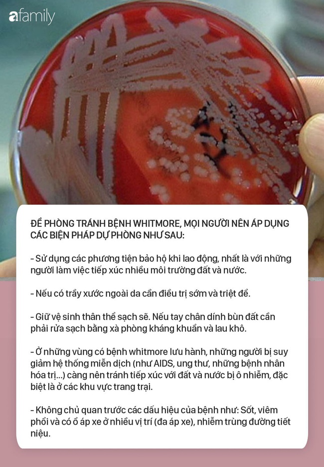 Đau xót một gia đình có 2 con nhỏ lần lượt tử vong trong chưa đầy 1 tháng, nghi nhiễm Whitmore - Ảnh 3. Đau xót một gia đình có 2 con nhỏ lần lượt tử vong trong chưa đầy 1 tháng, nghi nhiễm Whitmore - Ảnh 3.