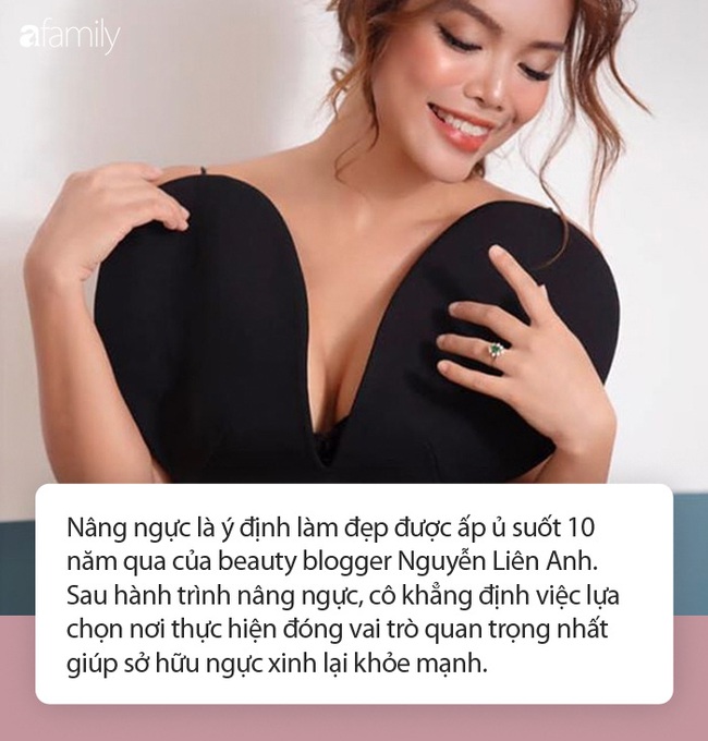 Hành trình nâng ngực từ &quot;chanh hóa bưởi&quot; của beauty blogger xinh đẹp từng ấp ủ tới 10 năm - Ảnh 1.