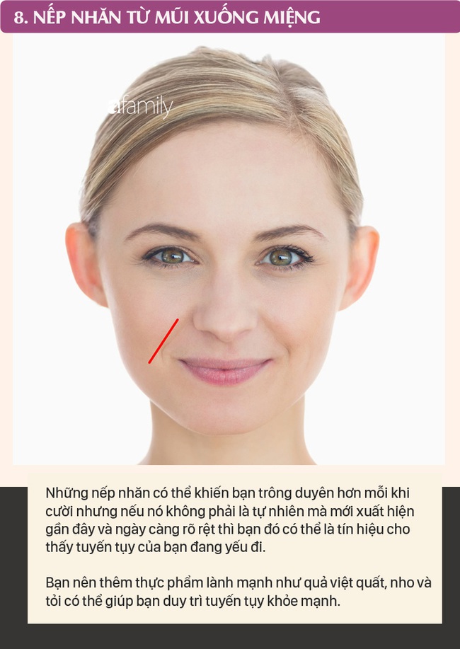 Mỗi nếp nhăn trên khuôn mặt gửi một thông điệp về sức khỏe, dưới đây là 10 vị trí nếp nhăn bạn cần nhận ra - Ảnh 8.