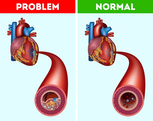 Ăn quả chà là mỗi ngày trong 1 tuần, 7 điều tuyệt vời này sẽ xảy ra với cơ thể - Ảnh 5.