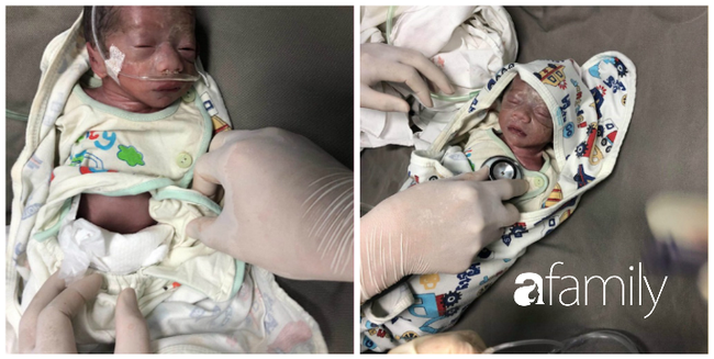 Sinh con non ở tuần thứ 28, nặng hơn 1,2 kg sau 4 tháng con được 7kg nhanh nhẹn họa bát, bí quyết của mẹ là đây - Ảnh 1.
