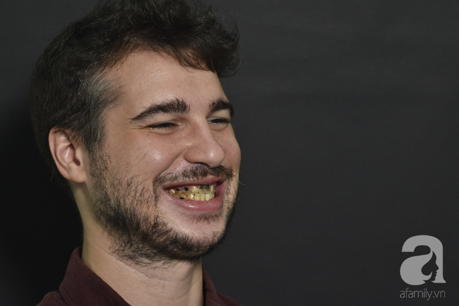 Chàng trai Mỹ 27 năm 'không dám cười' vì mang căn bệnh di truyền khiến răng luôn ố vàng hư hỏng nặng - Ảnh 4.