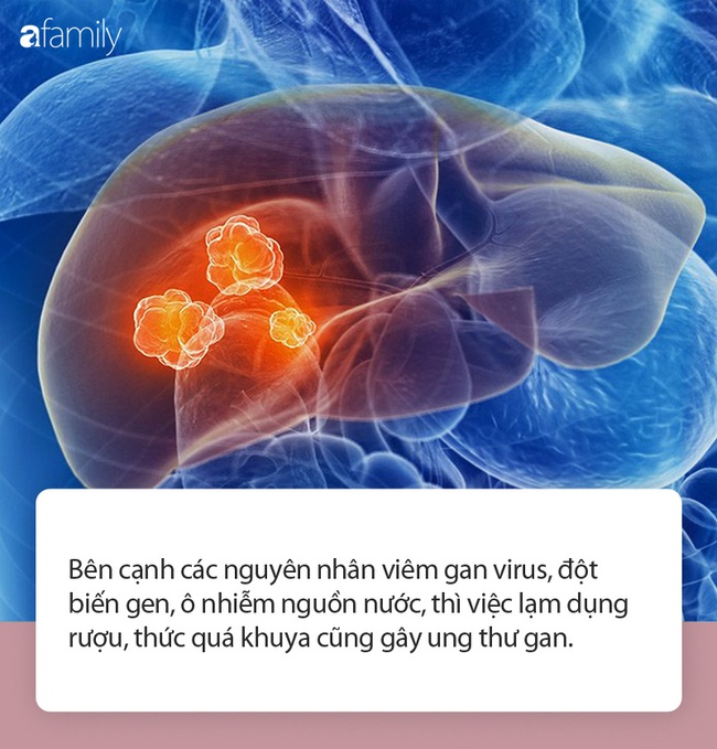 Chàng trai 28 tuổi bị ung thư gan với lá gan nặng hơn 5kg, thủ phạm là 2 thói quen rất nhiều người mắc - Ảnh 1.