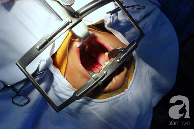 Sau khi bị chỉ trích dữ dội, Thành Long không có mặt trong kỷ niệm 30 năm Operation Smile tại Việt Nam - Ảnh 2. Sau khi bị chỉ trích dữ dội, Thành Long không có mặt trong kỷ niệm 30 năm Operation Smile tại Việt Nam - Ảnh 2.