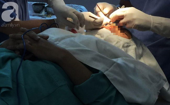 Người phụ nữ ngưng tim, ngưng thở khi đang gây mê nâng mũi tại viện thẩm mỹ phải chạy ECMO, nằm hồi sức cấp cứu - Ảnh 1.