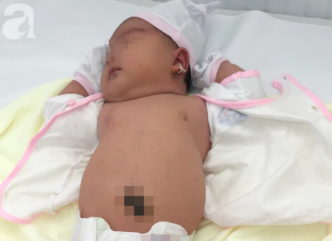 TP.HCM: Bác sĩ bệnh viện quận gây tê tủy sống sản phụ, đưa bé gái 5,2kg chào đời an toàn - Ảnh 1.