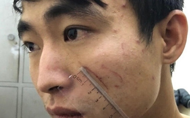 Hé lộ nguyên nhân đối tượng sát hại người yêu trong nhà nghỉ ở Sầm Sơn - Ảnh 1. Hé lộ nguyên nhân đối tượng sát hại người yêu trong nhà nghỉ ở Sầm Sơn - Ảnh 1.