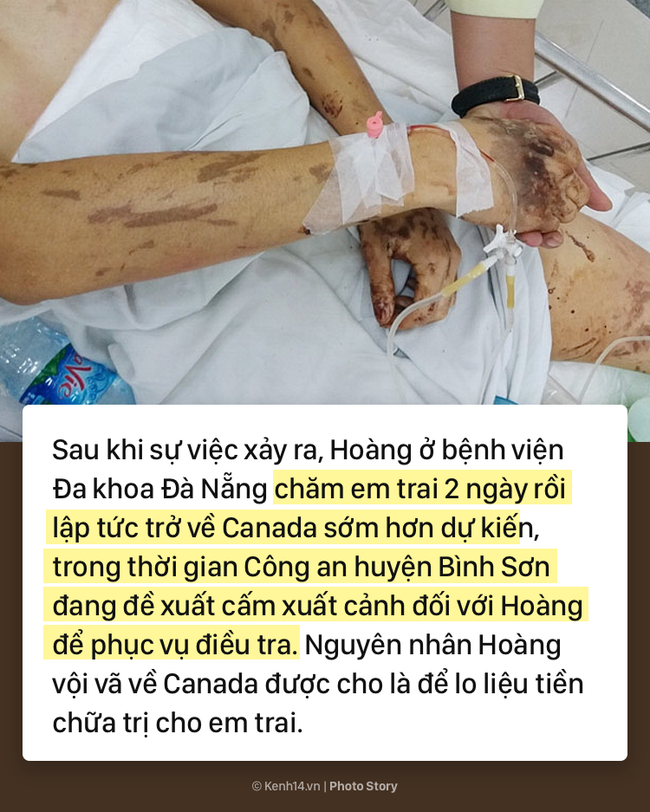 Toàn cảnh vụ Việt kiều bị tạt axit, cắt gân chân ở Quảng Ngãi và những tình tiết bất ngờ - Ảnh 11.