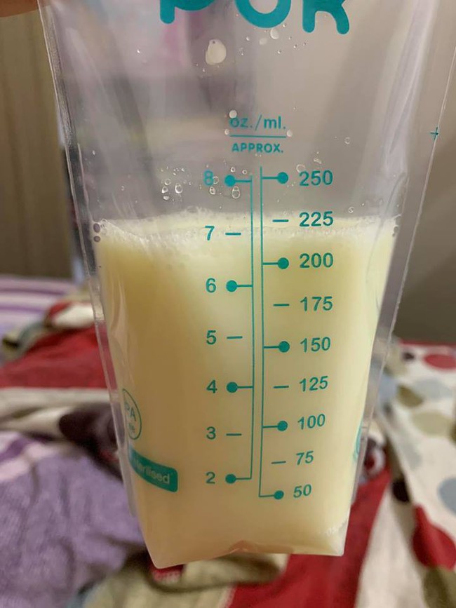 Bí quyết kích sữa sau mổ: Chia sẻ bí quyết kích sữa sau mổ bắt con - Ảnh 6.