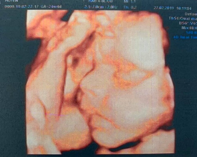 Hải Băng khoe ảnh siêu âm con thứ ba, tiết lộ thời gian chính thức đón bé chào đời - Ảnh 1.