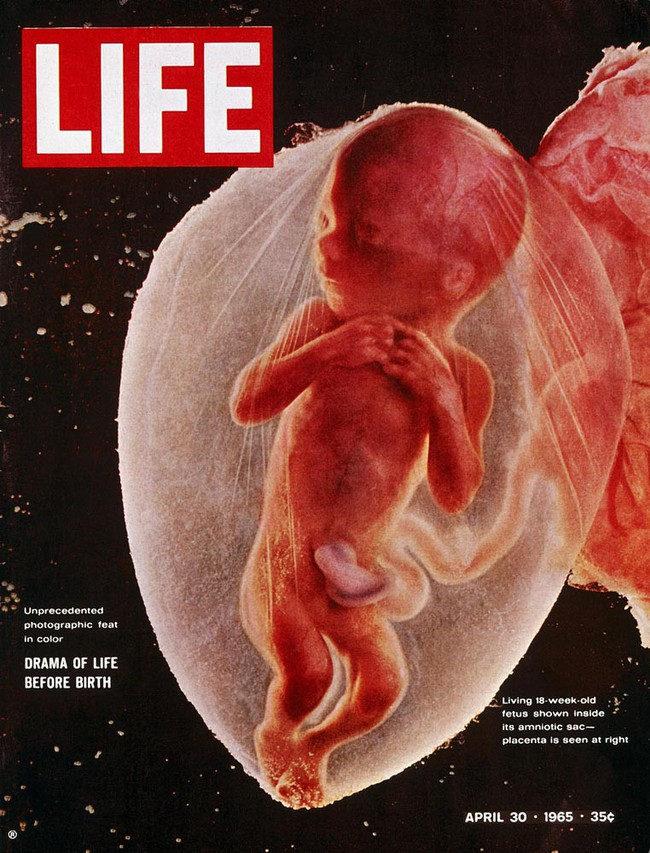 Câu chuyện chưa kể phía sau bức ảnh bào thai 18 tuần tuổi vào 5 thập kỉ trước, làm thay đổi thế giới với sức lan tỏa không tưởng - Ảnh 1.