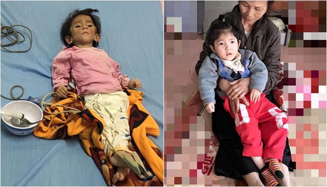 Xúc động với hình ảnh mới nhất của em bé Lào Cai: Nhi đã dài người đến mức mẹ rớt nước mắt không nhận ra - Ảnh 2.