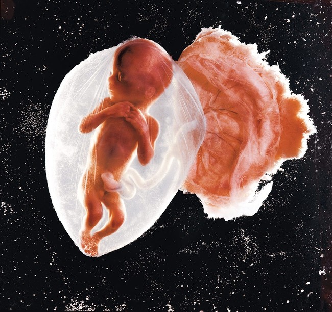 Câu chuyện chưa kể phía sau bức ảnh bào thai 18 tuần tuổi vào 5 thập kỉ trước, làm thay đổi thế giới với sức lan tỏa không tưởng - Ảnh 2.