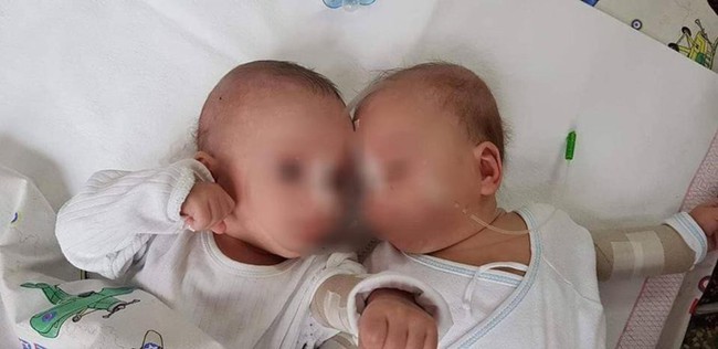 Bức hình cặp song sinh 5 tháng tuổi bị trói chặt trên giường bệnh và sự thật gây sốc khiến ai cũng phẫn nộ - Ảnh 1. Bức hình cặp song sinh 5 tháng tuổi bị trói chặt trên giường bệnh và sự thật gây sốc khiến ai cũng phẫn nộ - Ảnh 1.