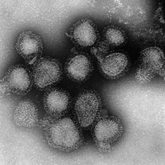 WHO cảnh báo: Đại dịch cúm là thảm họa tiếp theo sẽ xảy ra1 Chuyên gia khuyến cáo việc nên làm để phòng bệnh - Ảnh 2.