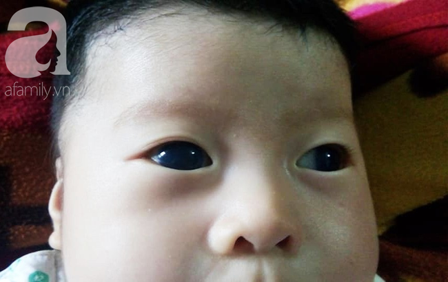 540 triệu đồng ủng hộ con gái mang đôi mắt xám tro của bà mẹ Phú Yên tội nghiệp - Ảnh 1.