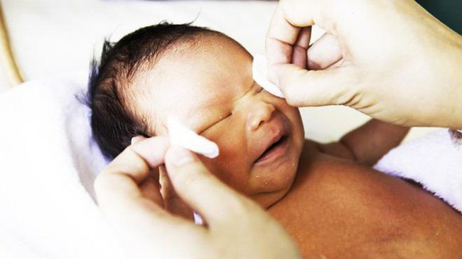 Cách xử trí khi bé sơ sinh bị tắc tuyến lệ và những điều mẹ cần biết để tránh nhiễm trùng cho con - Ảnh 3.