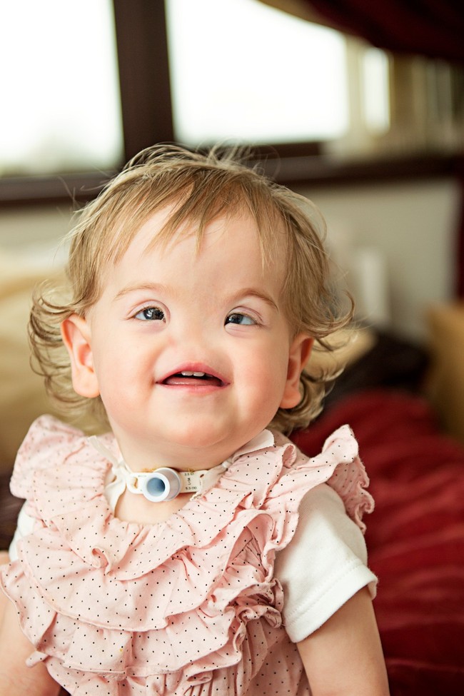 Ca sinh nở hiếm gặp: Em bé chào đời hoàn toàn không có mũi khiến bác sĩ cũng kinh ngạc vì chưa gặp bao giờ - Ảnh 4.