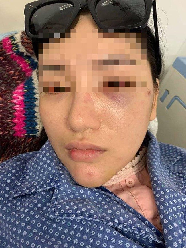Vụ cô gái trẻ bị đánh, lột quần áo giữa phố: Nạn nhân hoảng loạn, đang điều trị tại bệnh viện - Ảnh 4.