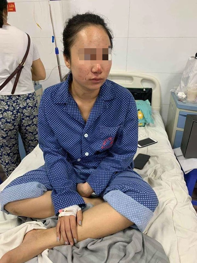 Vụ cô gái trẻ bị đánh, lột quần áo giữa phố: Nạn nhân hoảng loạn, đang điều trị tại bệnh viện - Ảnh 2.