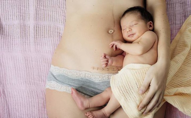 Mách các mẹ 4 tư thế nằm tốt nhất sau sinh mổ giúp mau chóng hồi phục sức khỏe - Ảnh 1.