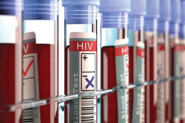 Xuất hiện bệnh nhân thứ 3 trên thế giới được chữa khỏi HIV - Ảnh 1.