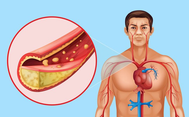 8 điều có thể xảy ra với cơ thể nếu bạn đều đặn ăn hạt lanh mỗi ngày - Ảnh 7.