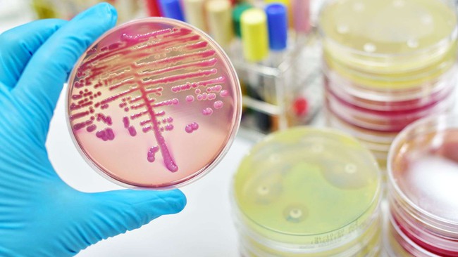 Cảnh báo: Siêu vi khuẩn nấm gây chết người đang lan truyền chóng mặt khắp toàn cầu - Ảnh 3.