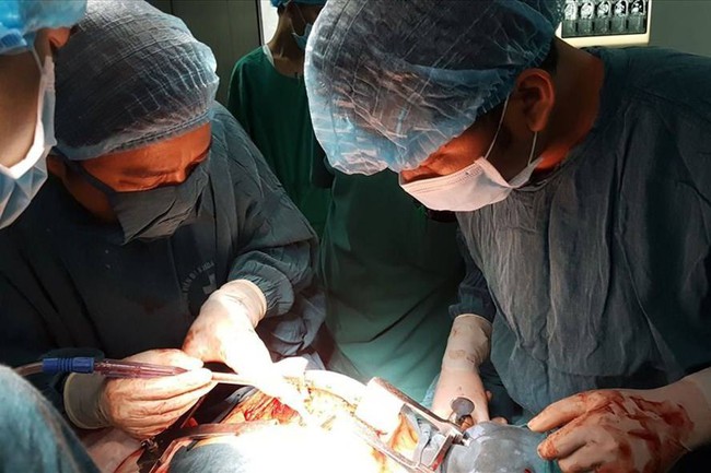 Phẫu thuật cắt khối u tuyến ức khủng cho nữ bệnh nhân - Ảnh 1.