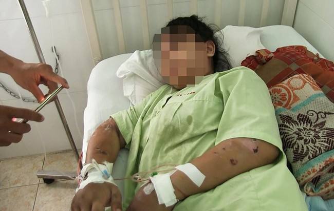 22 ngày sống trong địa ngục của cô gái 18 tuổi, mang bầu 6 tháng bị tra tấn, đánh đập đến sảy thai - Ảnh 2.
