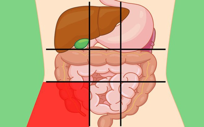 GS tiêu hóa chia sẻ: 7 vị trí đau bụng ai cũng cần biết để nhận diện mối nguy hiểm - Ảnh 3.