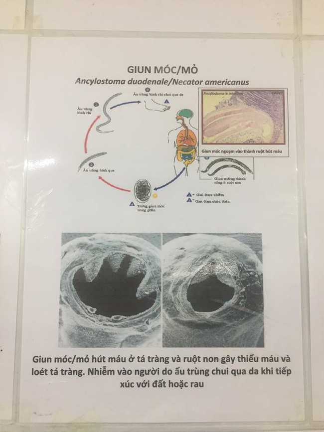 Con sốt triền miên không rõ nguyên nhân, mẹ đưa đi xét nghiệm mới tá hỏa biết con nhiễm loại kí sinh trùng kinh hãi - Ảnh 7.