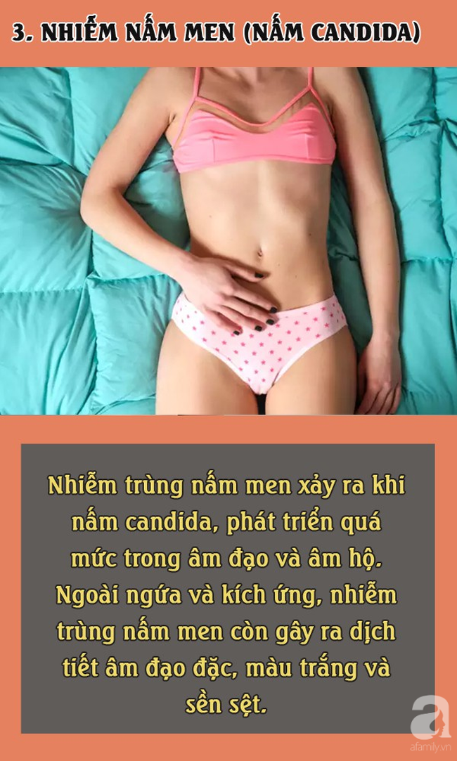 Bị ngứa âm đạo, chị em đừng chủ quan vì có thể do 5 nguyên nhân đáng ghét và ai cũng  muốn tránh - Ảnh 3.