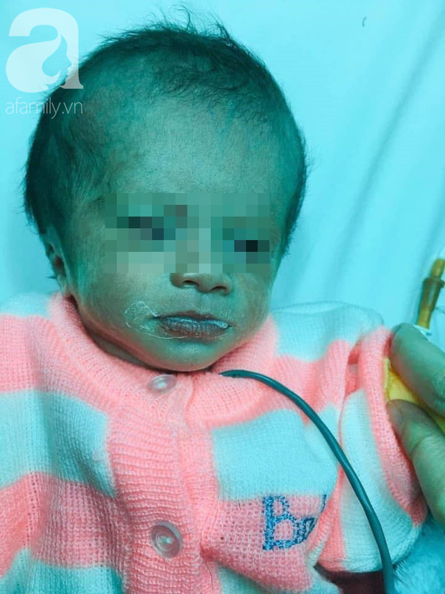 Lâm Đồng: Phát hiện bé gái sơ sinh bị treo trong bọc xốp ngoài rẫy cà phê khoảng 3 ngày, đầu thủng và có dòi trong mũi - Ảnh 1.