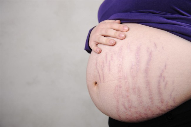Những sự thật về mang thai con nặng cân khiến nhiều mẹ “ngã ngửa” vì lầm tưởng bấy lâu - Ảnh 1.