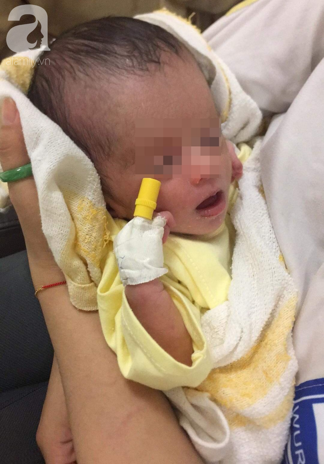 Bé gái sơ sinh ở Lâm Đồng bị mẹ bỏ trong bọc xốp treo trên cây 3 ngày, mũi có dòi không thể phát triển bình thường - Ảnh 1.