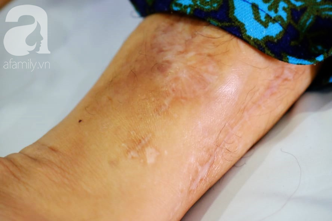 Thấy ra huyết âm đạo bất thường nhưng không đi khám ngay, người phụ nữ suy sụp khi phát hiện ung thư buồng trứng giai đoạn 3 - Ảnh 3. Thấy ra huyết âm đạo bất thường nhưng không đi khám ngay, người phụ nữ suy sụp khi phát hiện ung thư buồng trứng giai đoạn 3 - Ảnh 3.