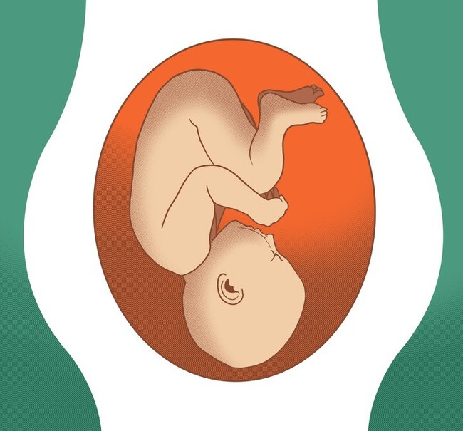 Giải mã cả một loạt các tư thế nằm chẳng ai ngờ đến của thai nhi trong bụng trước khi chào đời - Ảnh 2.