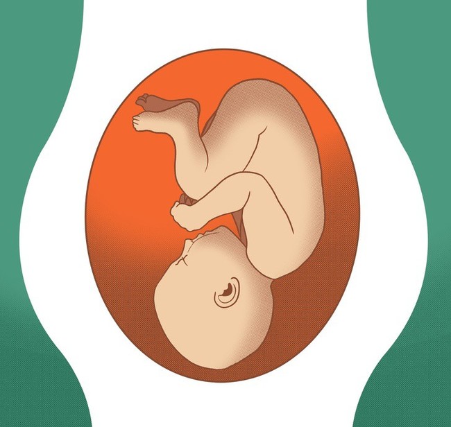 Giải mã cả một loạt các tư thế nằm chẳng ai ngờ đến của thai nhi trong bụng trước khi chào đời - Ảnh 3.