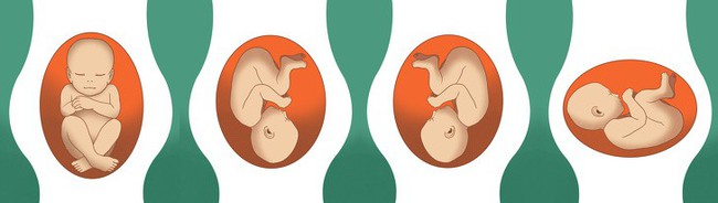 Giải mã cả một loạt các tư thế nằm chẳng ai ngờ đến của thai nhi trong bụng trước khi chào đời - Ảnh 1.