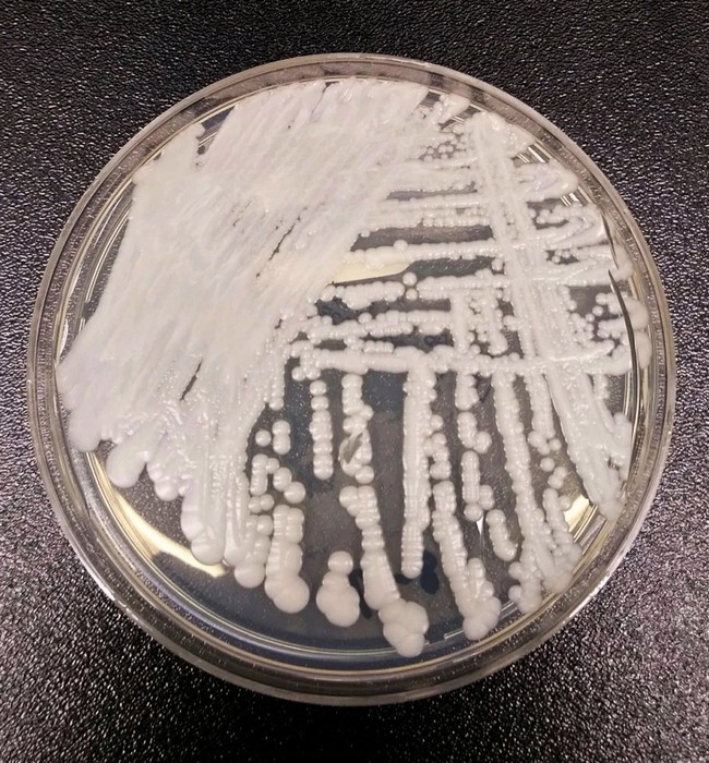 Dấu hiệu cảnh báo bạn có thể bị nhiễm siêu vi khuẩn nấm đang hoành hành trên toàn cầu và đe dọa tính mạng - Ảnh 4.