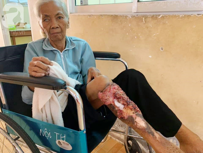 Hi vọng đến với người bà 70 tuổi mù một bên mắt, chân bị hoại tử, thối rữa nặng khi được mọi người giúp đỡ - Ảnh 13.