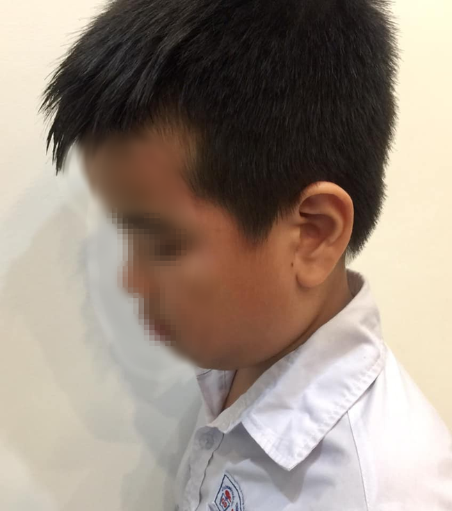 Hải Phòng: Cô giáo tát tím thái dương học sinh lớp 2 trong giờ kiểm tra vì làm bài chậm - Ảnh 1. Hải Phòng: Cô giáo tát tím thái dương học sinh lớp 2 trong giờ kiểm tra vì làm bài chậm - Ảnh 1.