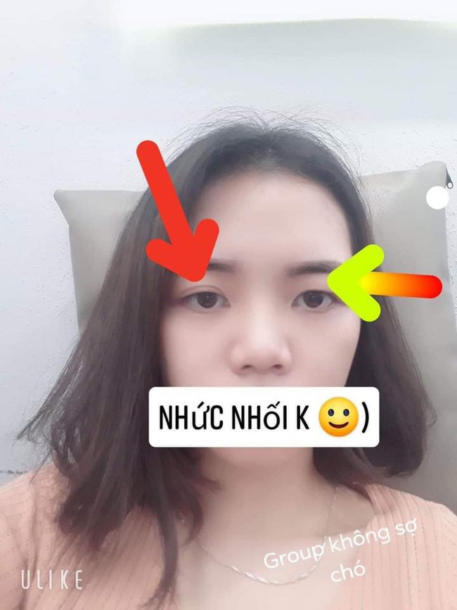 Cô gái được nhiều người đồng cảm khi có full combo mắt 2 mí lẫn 1 mí, nhưng bất ngờ nhất vẫn là trường hợp cuối cùng - Ảnh 1.