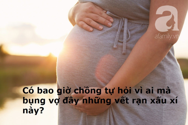 Sinh con một năm mà chồng vẫn chẳng đả động chuyện chăn gối, tôi làm liều gạ gẫm thì chồng nói một câu như sét đánh ngang tai! - Ảnh 2.