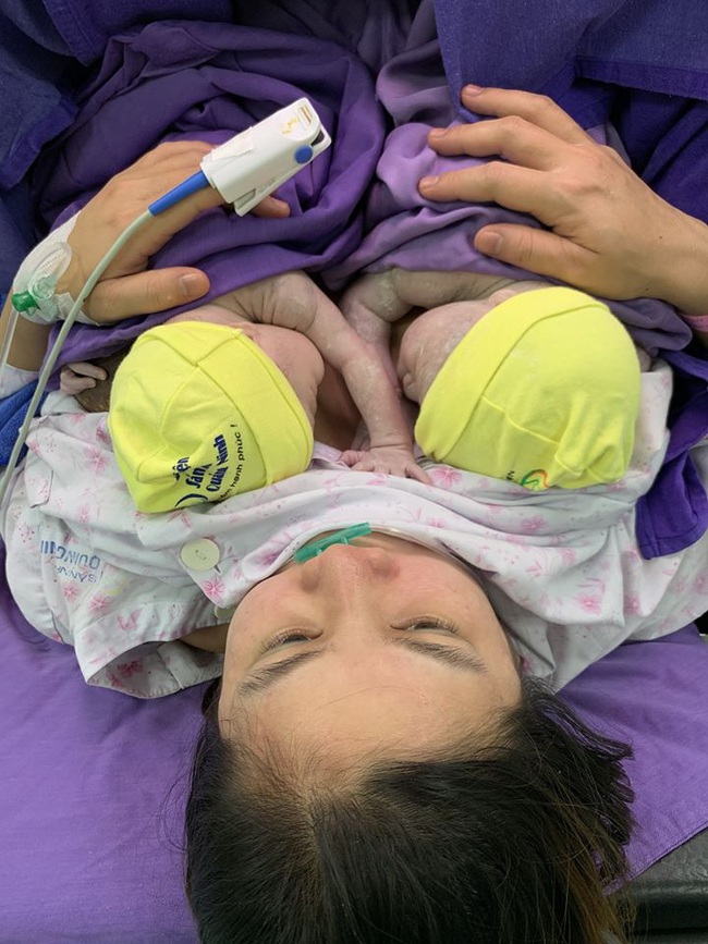 Cặp sinh đôi chào đời còn nguyên trong bọc ối tại Bệnh viện Sản Nhi Quảng Ninh - Ảnh 1.