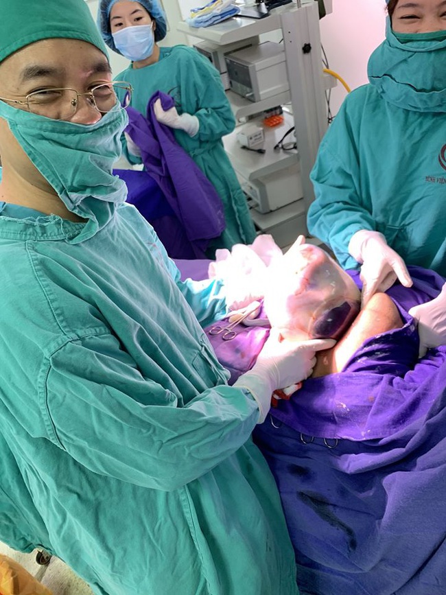 Cặp sinh đôi chào đời còn nguyên trong bọc ối tại Bệnh viện Sản Nhi Quảng Ninh - Ảnh 3.