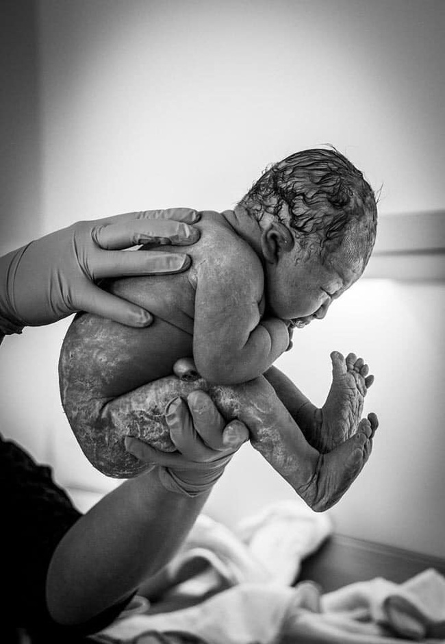 Bất ngờ với bộ ảnh chụp tư thế bé sơ sinh chào đời “lọt thỏm” tạo dáng y như còn nằm trong bụng mẹ - Ảnh 13.