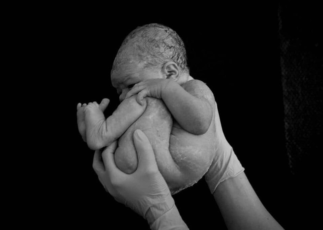 Bất ngờ với bộ ảnh chụp tư thế bé sơ sinh chào đời “lọt thỏm” tạo dáng y như còn nằm trong bụng mẹ - Ảnh 2.